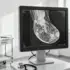 AI’s Healthcare Invasion and the Jobs It’s Coming For
